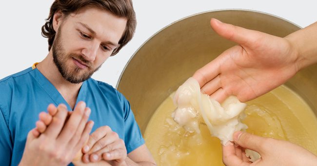 Quimipur-blog-parafina-rehabilitacion-fisioterapia-cabecera Tratamiento fisioterapéutico con parafinas